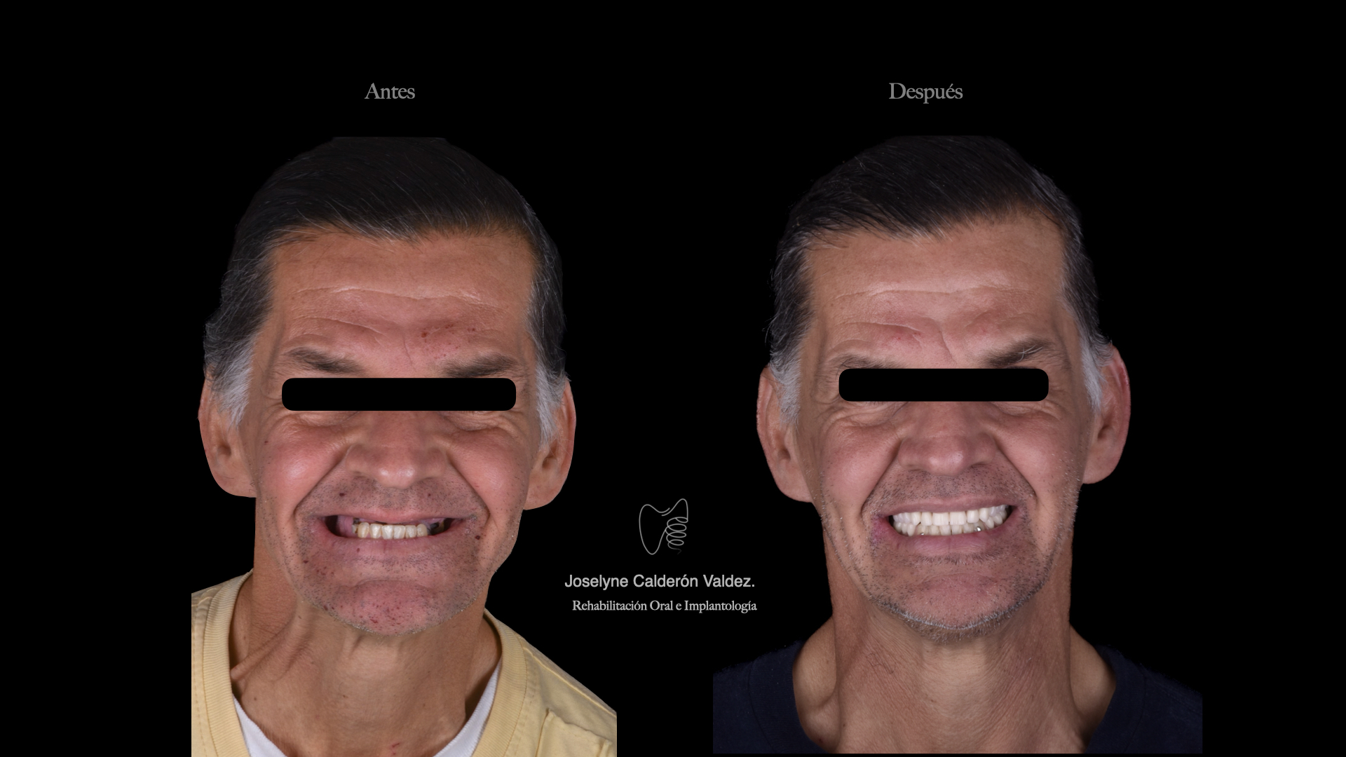 Caso clínico comparativo de antes y después